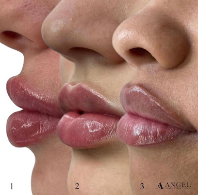 Angel Aesthetics Clinic Brisbane